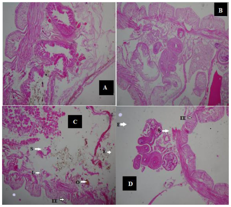 Histopathological effects and biomarker response of earthworms, Eisenia fetida, after exposure to crude oil contaminated soils.