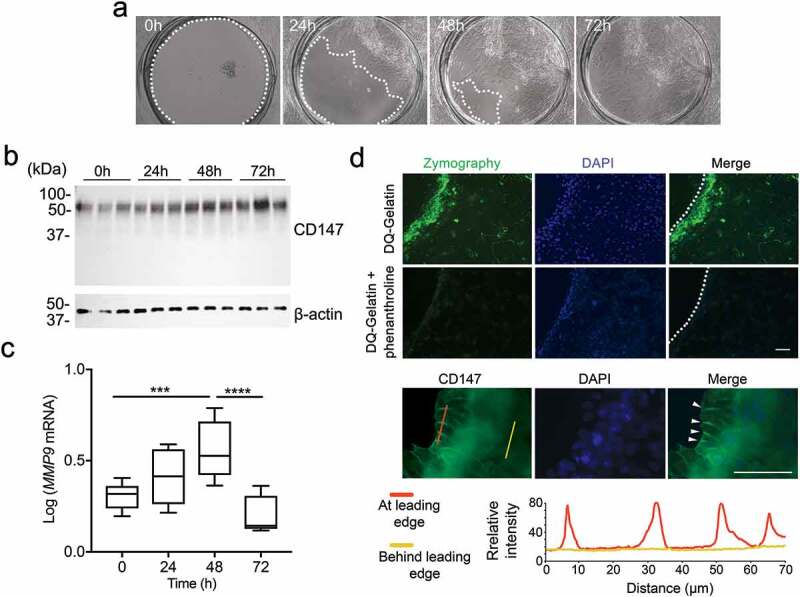 Golgi α1,2-mannosidase I induces clustering and compartmentalization of CD147 during epithelial cell migration.