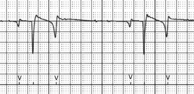 Evaluation of a smartphone-based electrocardiogram device accuracy in field and in hospital conditions in horses.