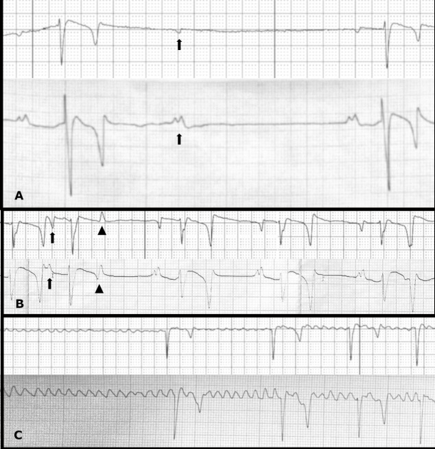 Evaluation of a smartphone-based electrocardiogram device accuracy in field and in hospital conditions in horses.