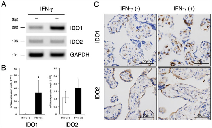 Localization of Indoleamine 2,3-Dioxygenase-1 and Indoleamine 2,3-Dioxygenase-2 at the Human Maternal-Fetal Interface.