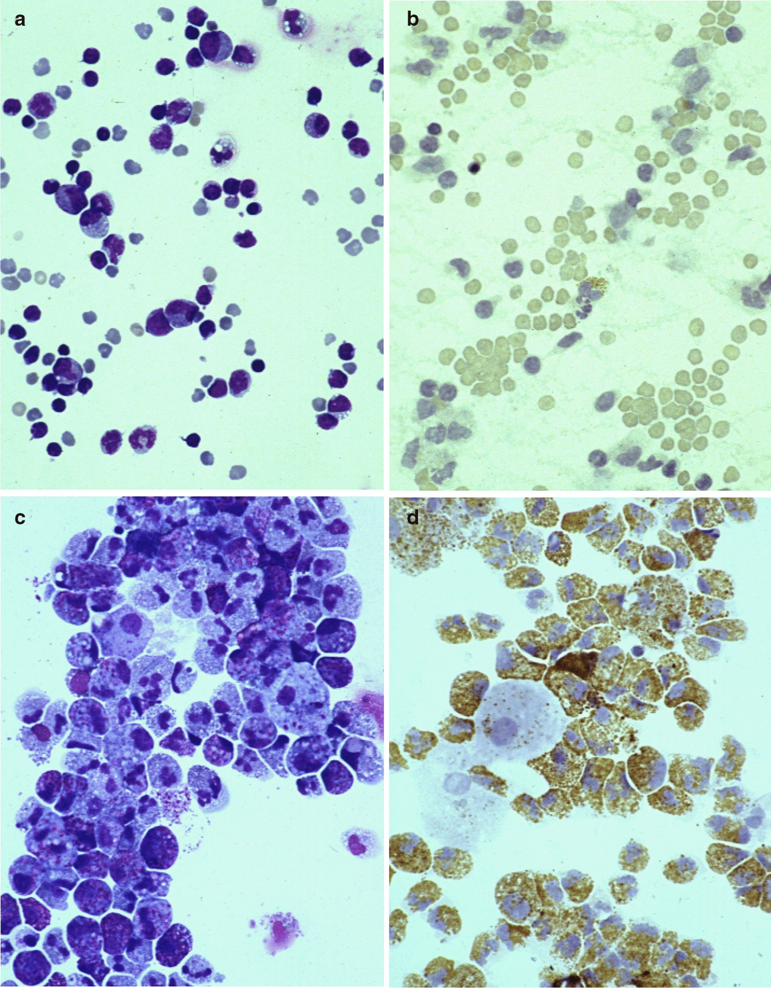 Dexamethasone and lidocaine suppress eosinophilopoiesis from umbilical cord blood cells.