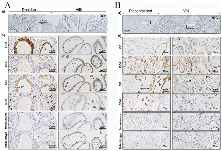 Localization of Indoleamine 2,3-Dioxygenase-1 and Indoleamine 2,3-Dioxygenase-2 at the Human Maternal-Fetal Interface.