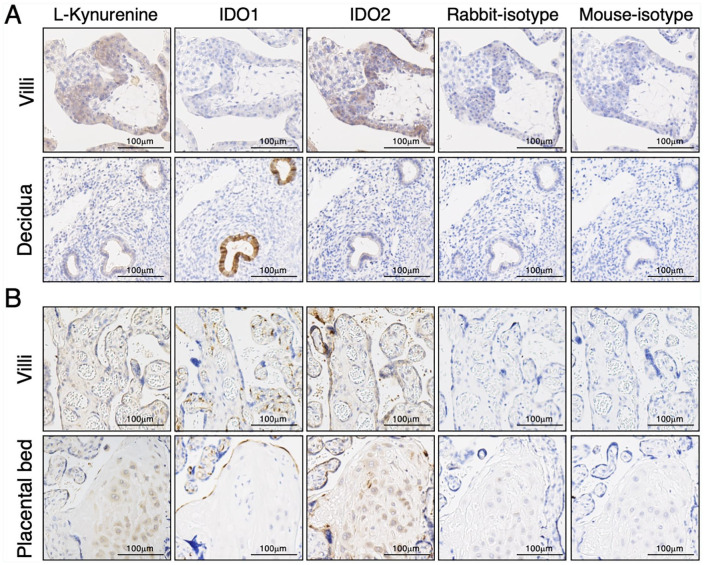 Localization of Indoleamine 2,3-Dioxygenase-1 and Indoleamine 2,3-Dioxygenase-2 at the Human Maternal-Fetal Interface.