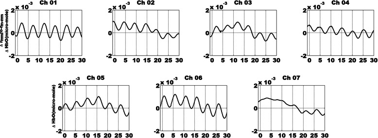 Functional near-infrared spectroscopy can detect low-frequency hemodynamic oscillations in the prefrontal cortex during steady-state visual evoked potential-inducing periodic facial expression stimuli presentation.