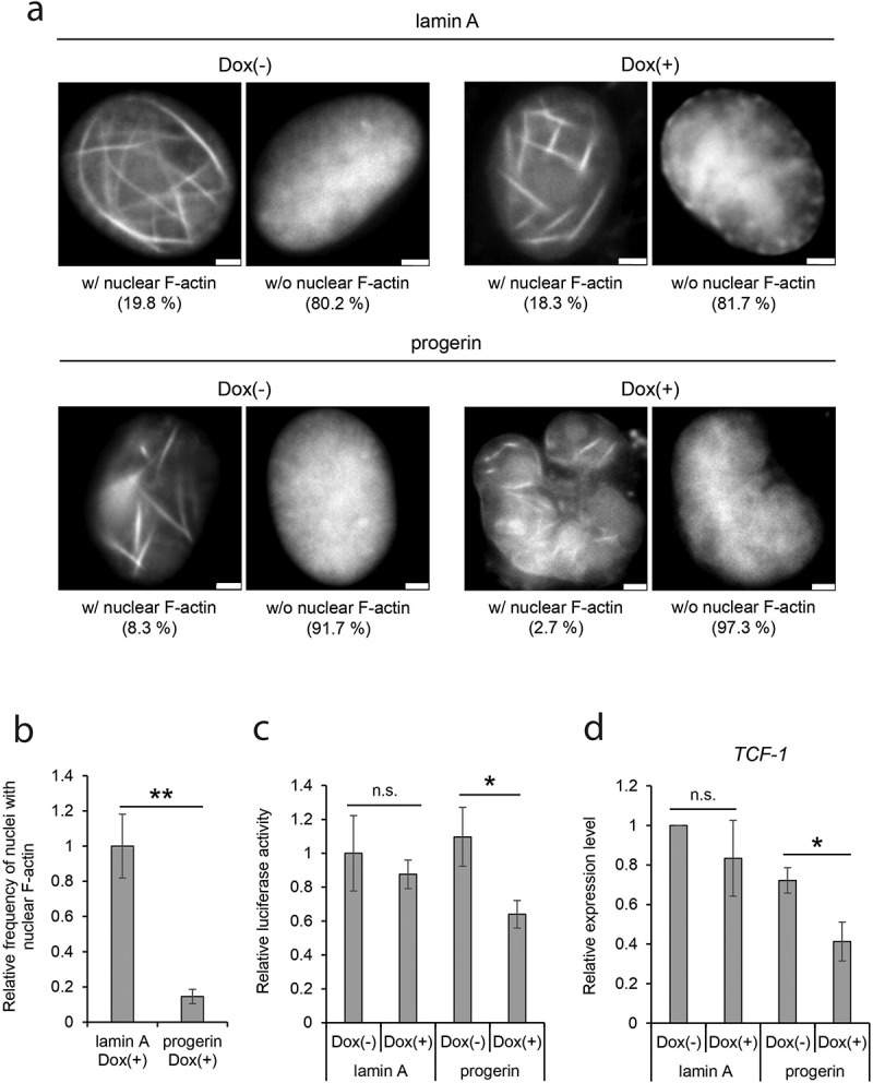 Impairment of nuclear F-actin formation and its relevance to cellular phenotypes in Hutchinson-Gilford progeria syndrome.