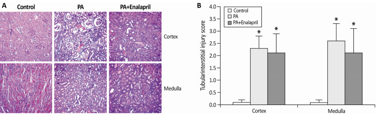 Association of Proteinuria with Urinary Concentration Defect in Puromycin Aminonucleoside Nephrosis.