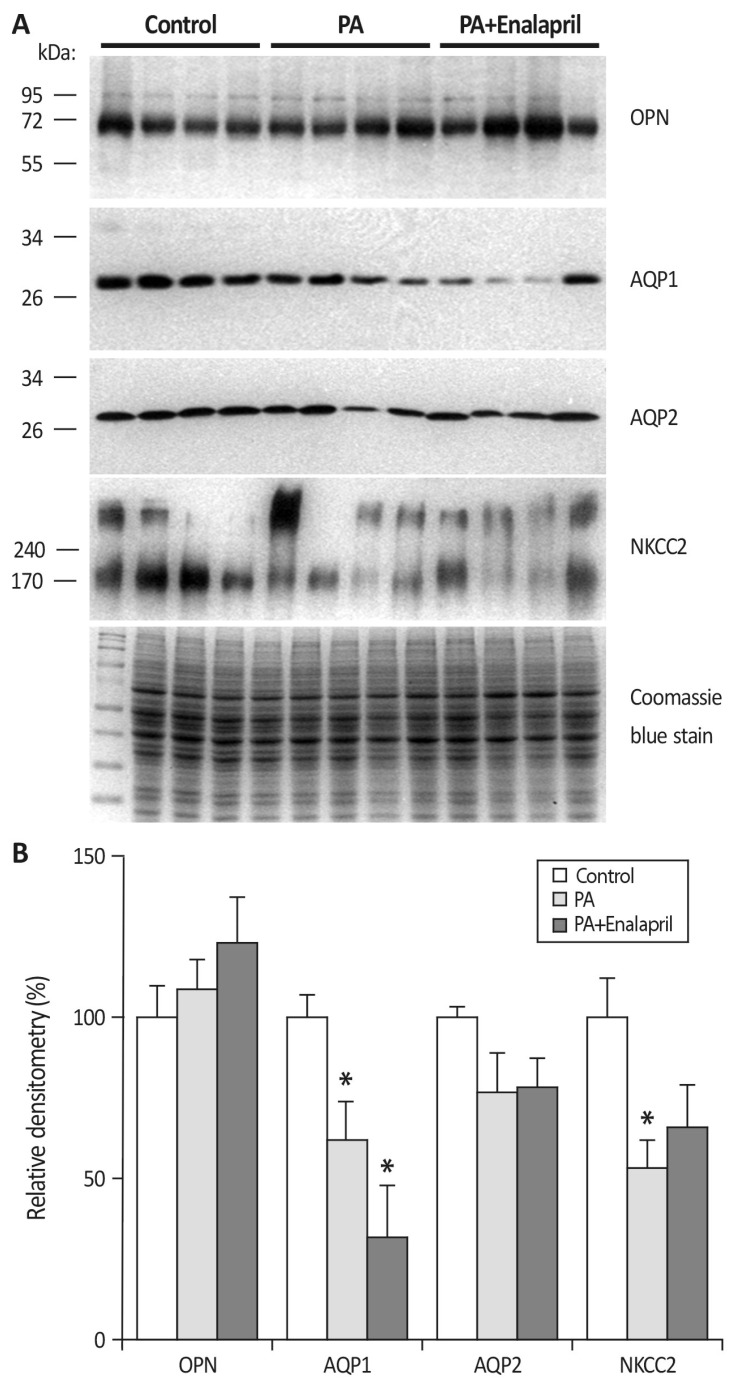 Association of Proteinuria with Urinary Concentration Defect in Puromycin Aminonucleoside Nephrosis.