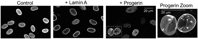 Lamin microaggregates lead to altered mechanotransmission in progerin-expressing cells.