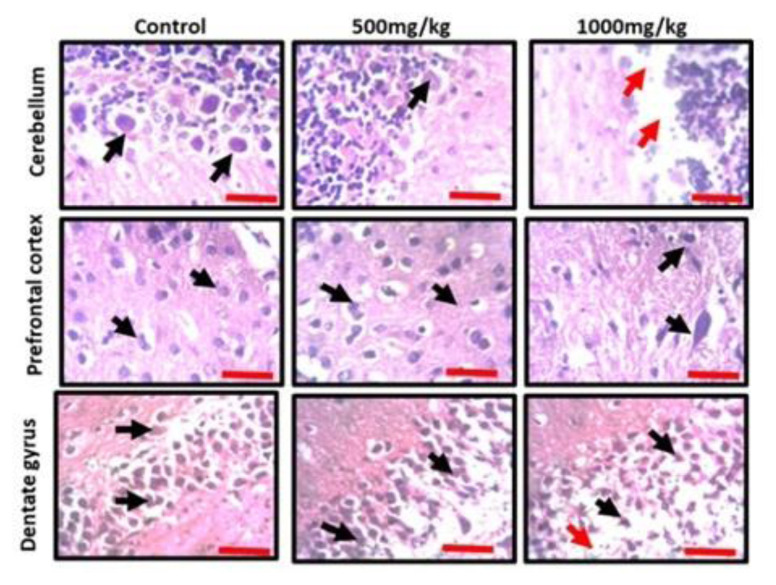 Permethrin exposure affects neurobehavior and cellular characterization in rats' brain.