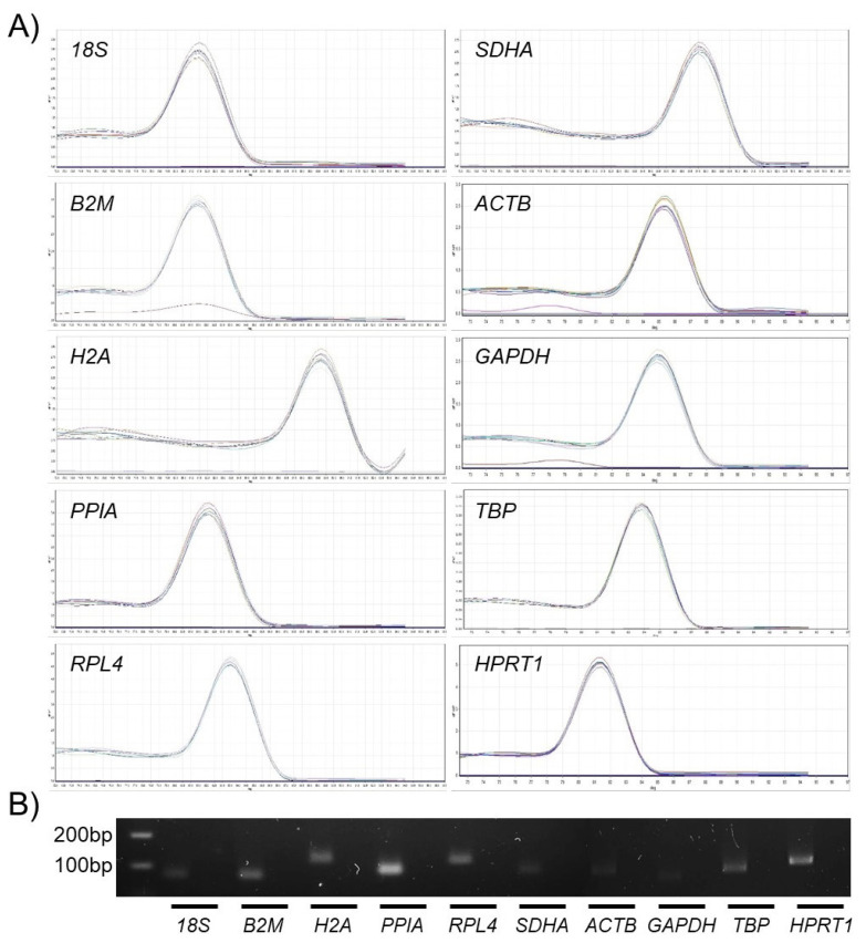 TATA box binding protein and ribosomal protein 4 are suitable reference genes for normalization during quantitative polymerase chain reaction study in bovine mesenchymal stem cells.