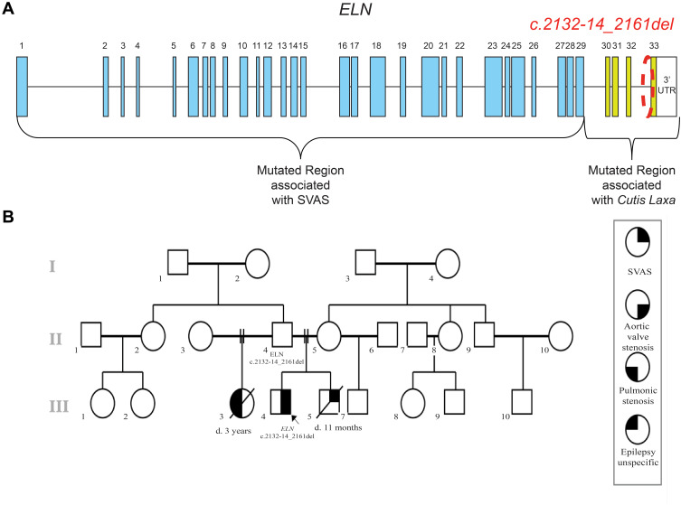 A Novel Splice-Site Mutation in the <i>ELN</i> Gene Suggests an Alternative Mechanism for Vascular Elastinopathies.