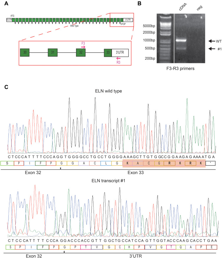 A Novel Splice-Site Mutation in the <i>ELN</i> Gene Suggests an Alternative Mechanism for Vascular Elastinopathies.