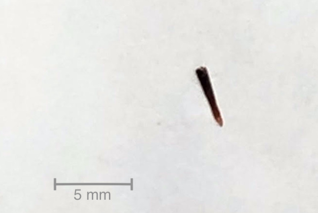 Septic arthritis of the knee due to <i>Pantoea</i> <i>agglomerans</i>: look for the thorn.