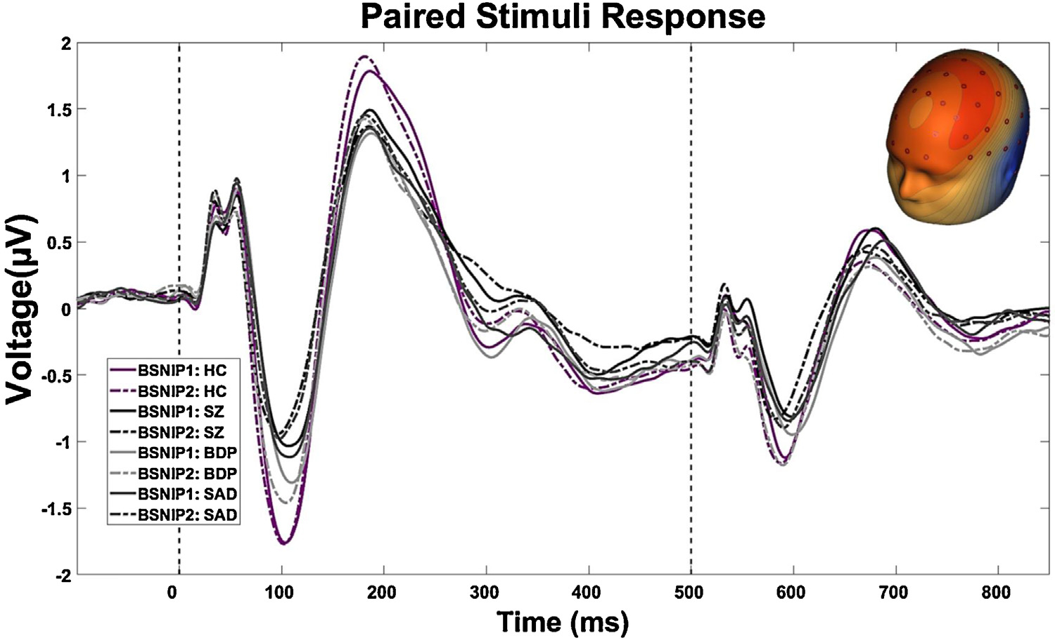 Auditory paired-stimuli responses across the psychosis and bipolar spectrum and their relationship to clinical features