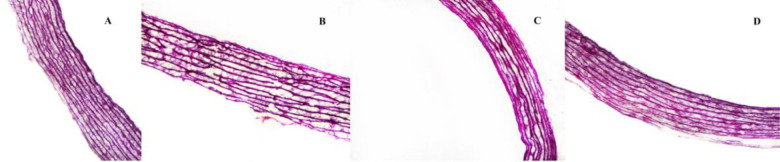 Effect of intracellular uptake of nanoparticle-encapsulated trehalose on the hemocompatibility of allogeneic valves in the VS83 vitrification protocol.