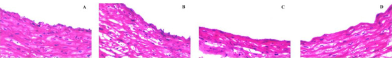 Effect of intracellular uptake of nanoparticle-encapsulated trehalose on the hemocompatibility of allogeneic valves in the VS83 vitrification protocol.