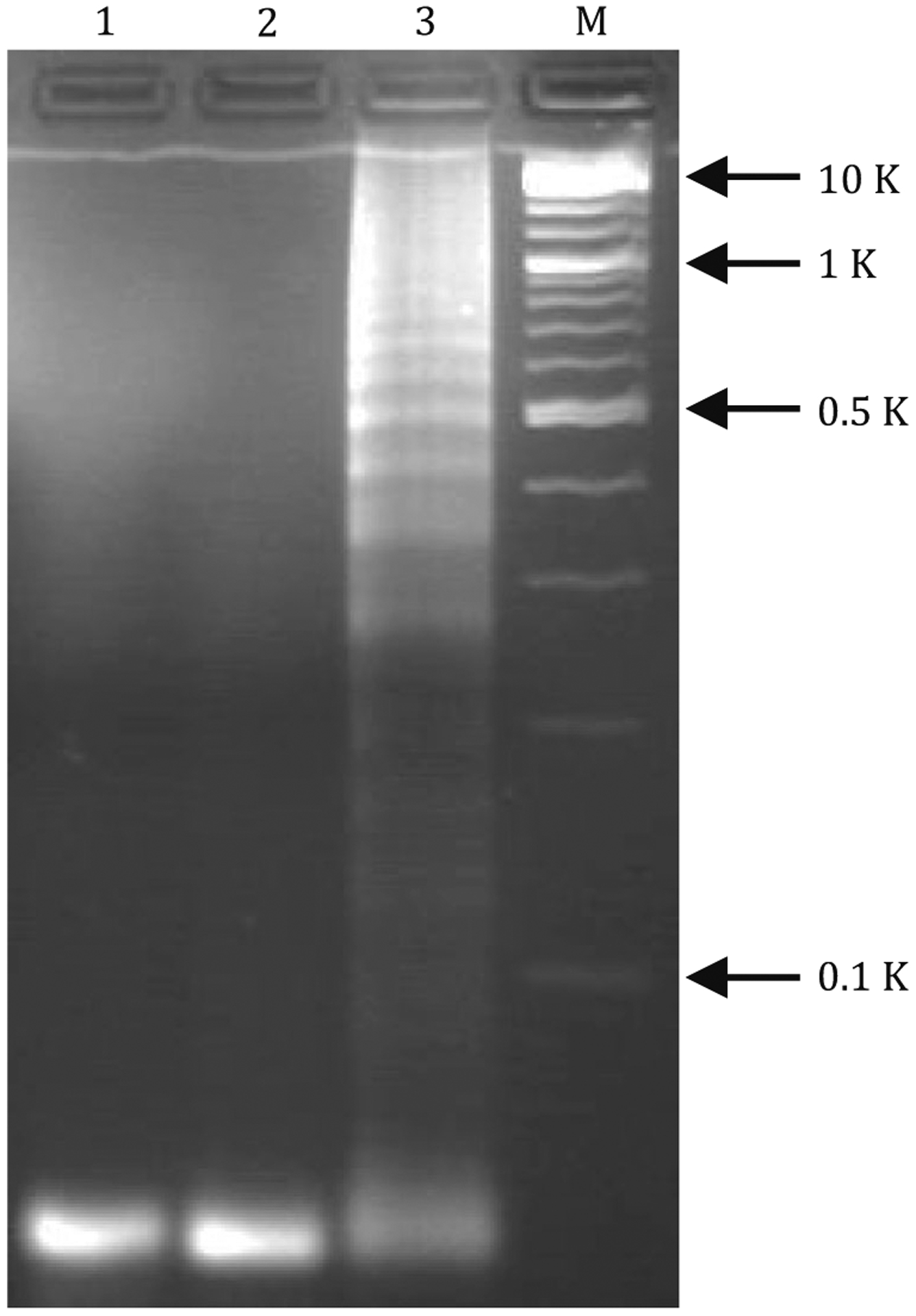 ExoHCR: a sensitive assay to profile PD-L1 level on tumor exosomes for immunotherapeutic prognosis.