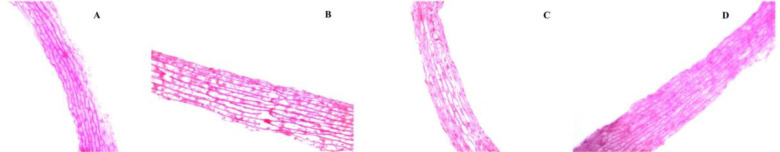 Effect of intracellular uptake of nanoparticle-encapsulated trehalose on the hemocompatibility of allogeneic valves in the VS83 vitrification protocol.