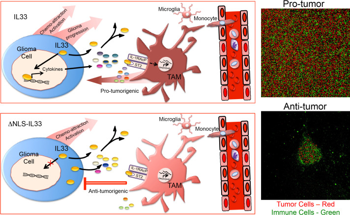 To promote or inhibit glioma progression, that is the question for IL-33.