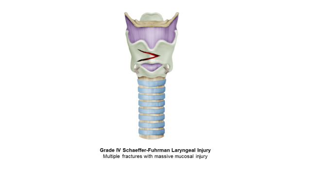 Damage control of laryngotracheal trauma: the golden day.