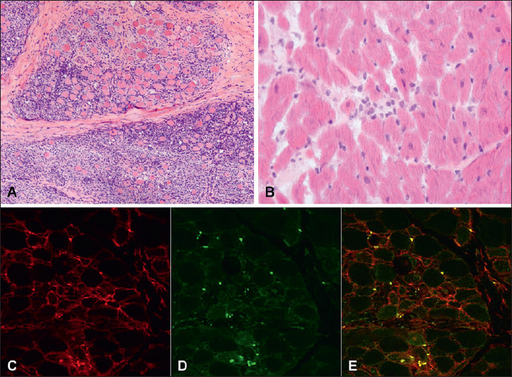 The correlation between cardiac and skeletal muscle pathology in animal models of idiopathic inflammatory myopathies.