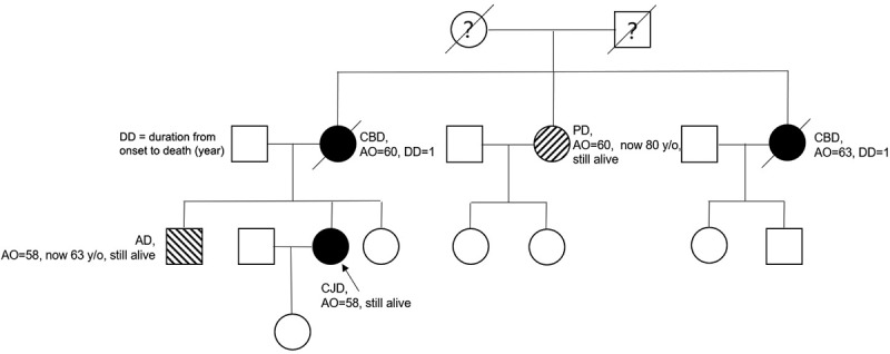 Corticobasal manifestations of Creutzfeldt-Jakob disease with D178N-homozygous 129M genotype.