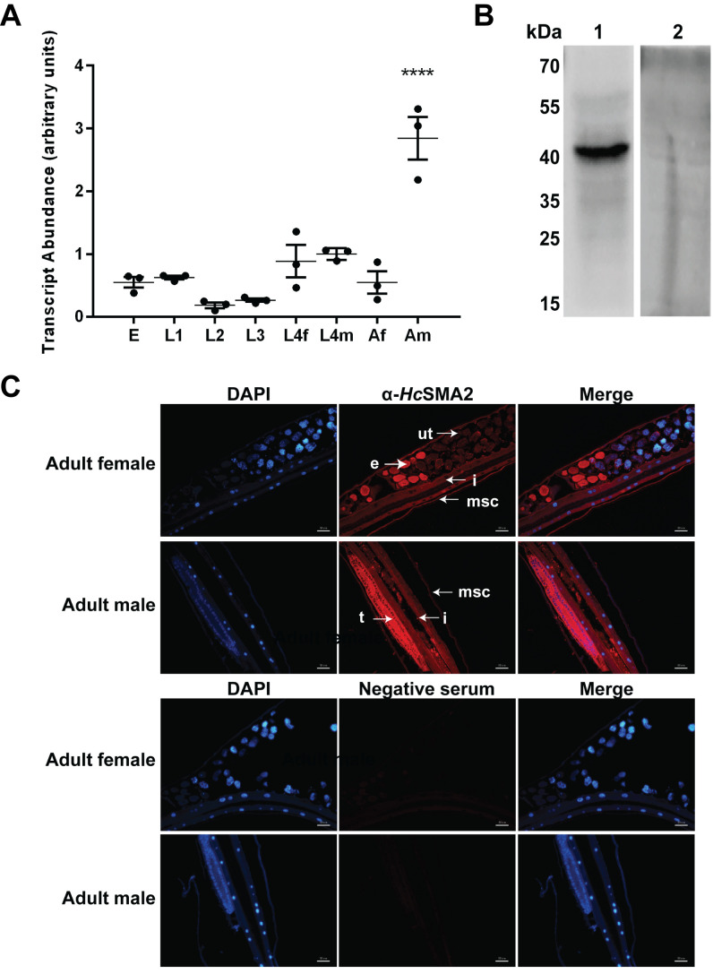 A novel BR-SMAD is required for larval development in barber's pole worm <i>Haemonchus contortus</i>.