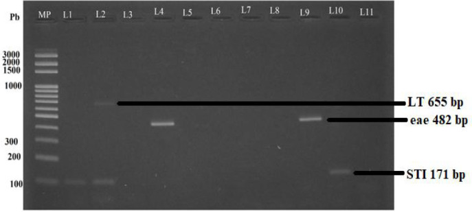 DETECTION OF DIARRHEAGENIC <i>ESCHERICHIA COLI</i> IN HUMAN DIARRHEIC STOOL AND DRINKING WATER SAMPLES IN OUAGADOUGOU, BURKINA FASO.