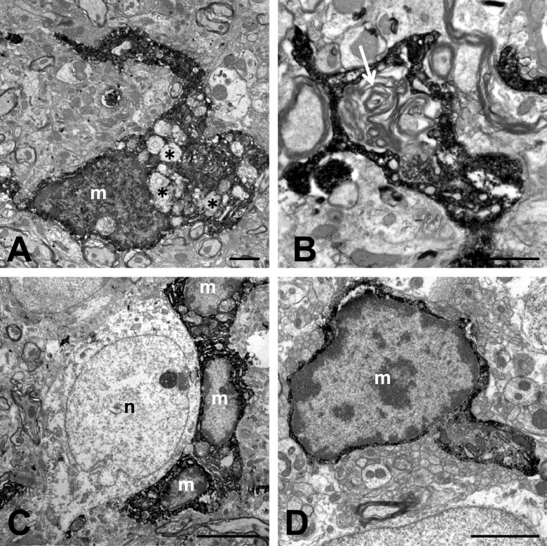 Minocycline Alleviates Cluster Formation of Activated Microglia and Age-dependent Dopaminergic Cell Death in the Substantia Nigra of Zitter Mutant Rat.