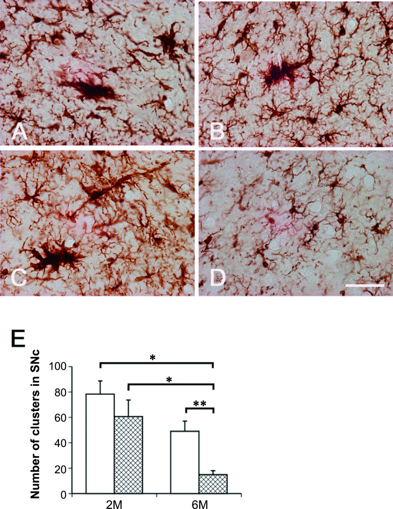 Minocycline Alleviates Cluster Formation of Activated Microglia and Age-dependent Dopaminergic Cell Death in the Substantia Nigra of Zitter Mutant Rat.