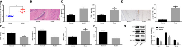 Disruption of microRNA-214 during general anaesthesia prevents brain injury and maintains mitochondrial fusion by promoting Mfn2 interaction with Pkm2.