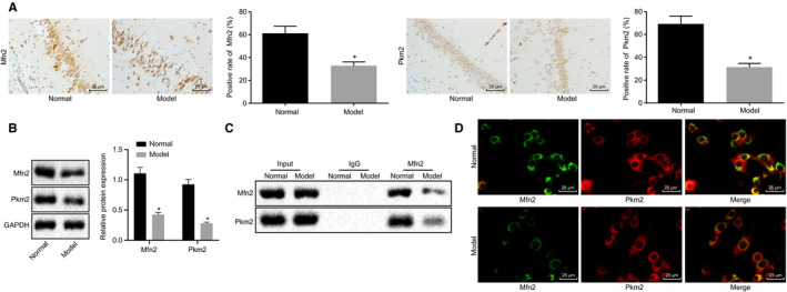 Disruption of microRNA-214 during general anaesthesia prevents brain injury and maintains mitochondrial fusion by promoting Mfn2 interaction with Pkm2.