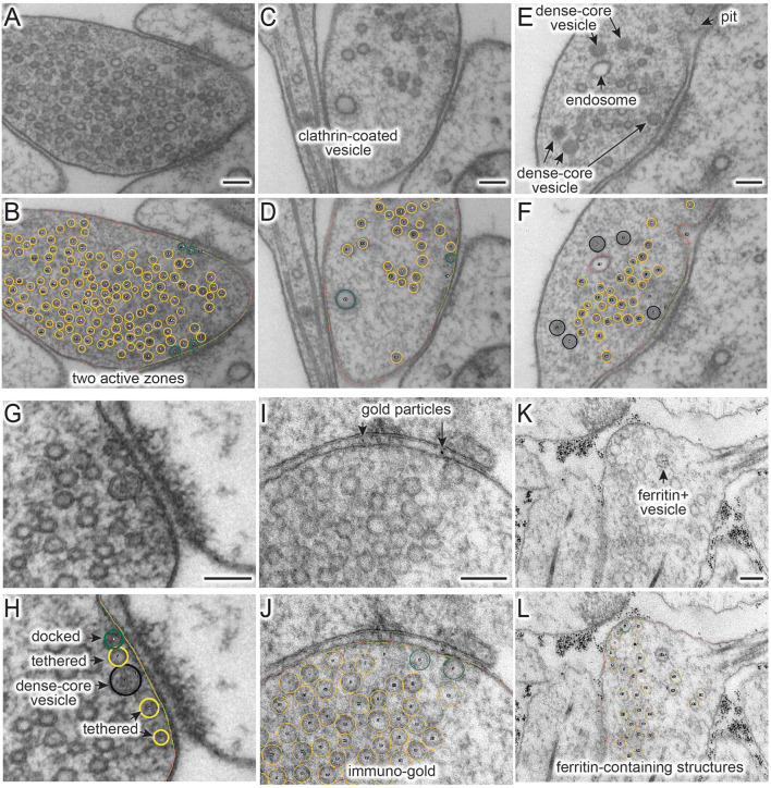 SynapsEM: Computer-Assisted Synapse Morphometry.