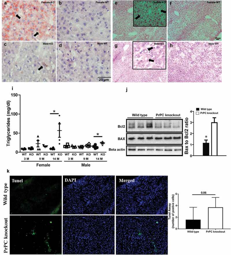 The role of cellular prion protein in lipid metabolism in the liver.