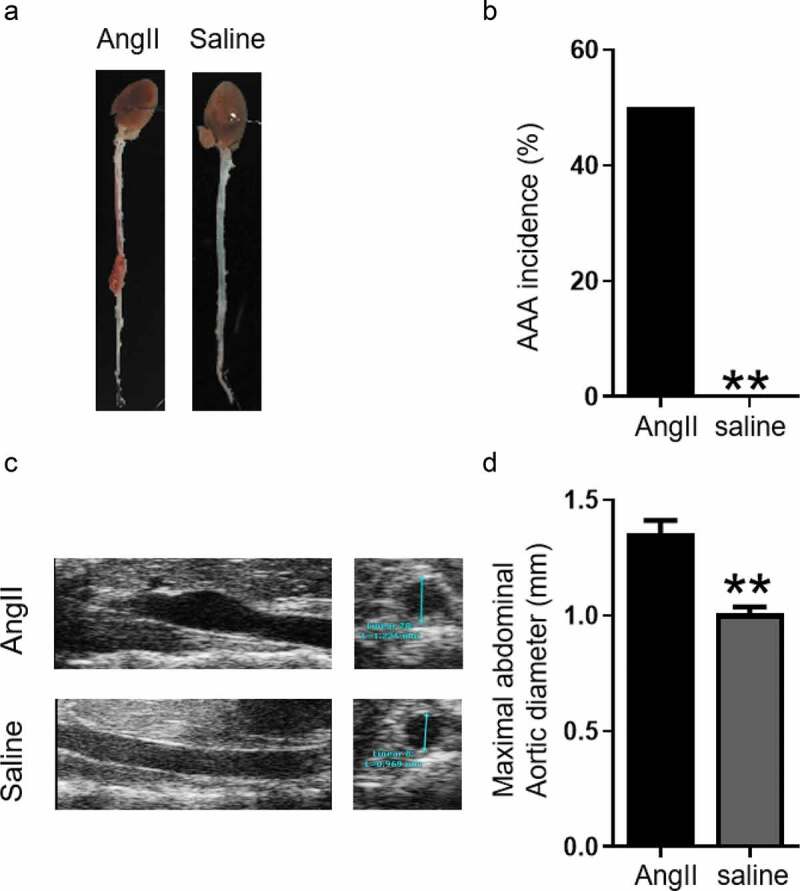 TRPV1 inhibits smooth muscle cell phenotype switching in a mouse model of abdominal aortic aneurysm.