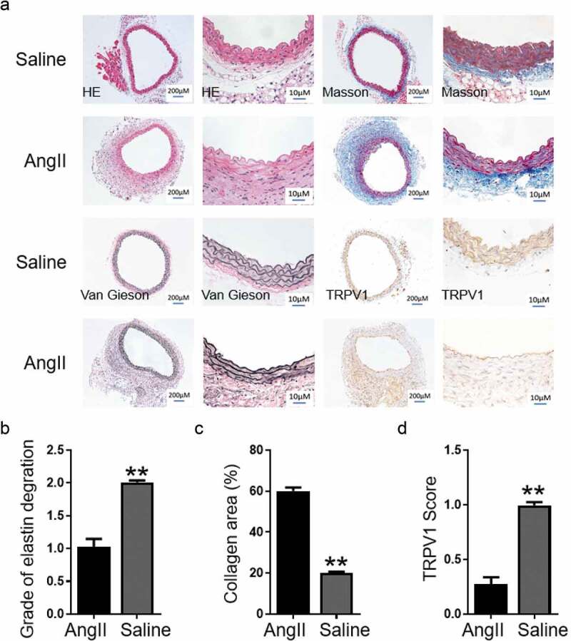 TRPV1 inhibits smooth muscle cell phenotype switching in a mouse model of abdominal aortic aneurysm.