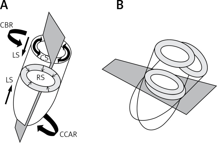 The strain and strain rate imaging paradox in echocardiography: overabundant literature in the last two decades but still uncertain clinical utility in an individual case.