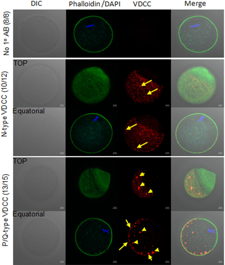 Voltage Dependent N Type Calcium Channel in Mouse Egg Fertilization.