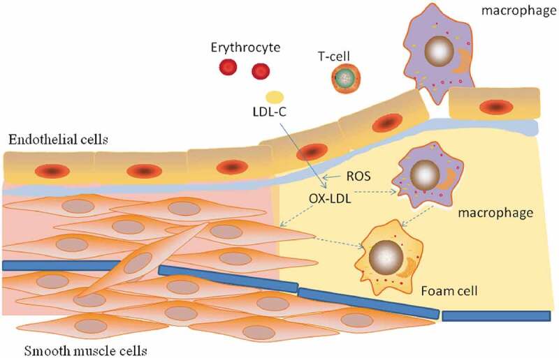 The role of TRPV1 channels in atherosclerosis.