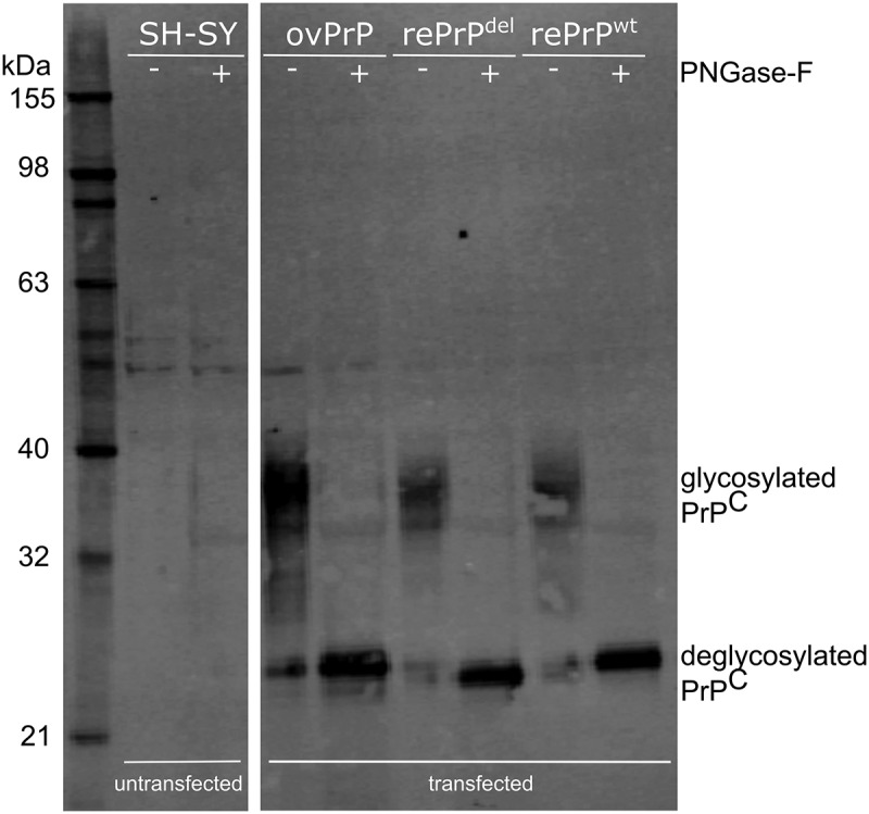 Chronic wasting disease associated with prion protein gene (<i>PRNP</i>) variation in Norwegian wild reindeer (<i>Rangifer tarandus</i>).