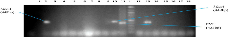 NASAL CARRIAGE OF MULTI-DRUG RESISTANT PANTON VALENTINE LEUKOCIDIN POSITIVE <i>STAPHYLOCOCCUS AUREUS</i> IN HEALTHY INDIVIDUALS OF TUDUN-WADA, GOMBE STATE, NIGERIA.