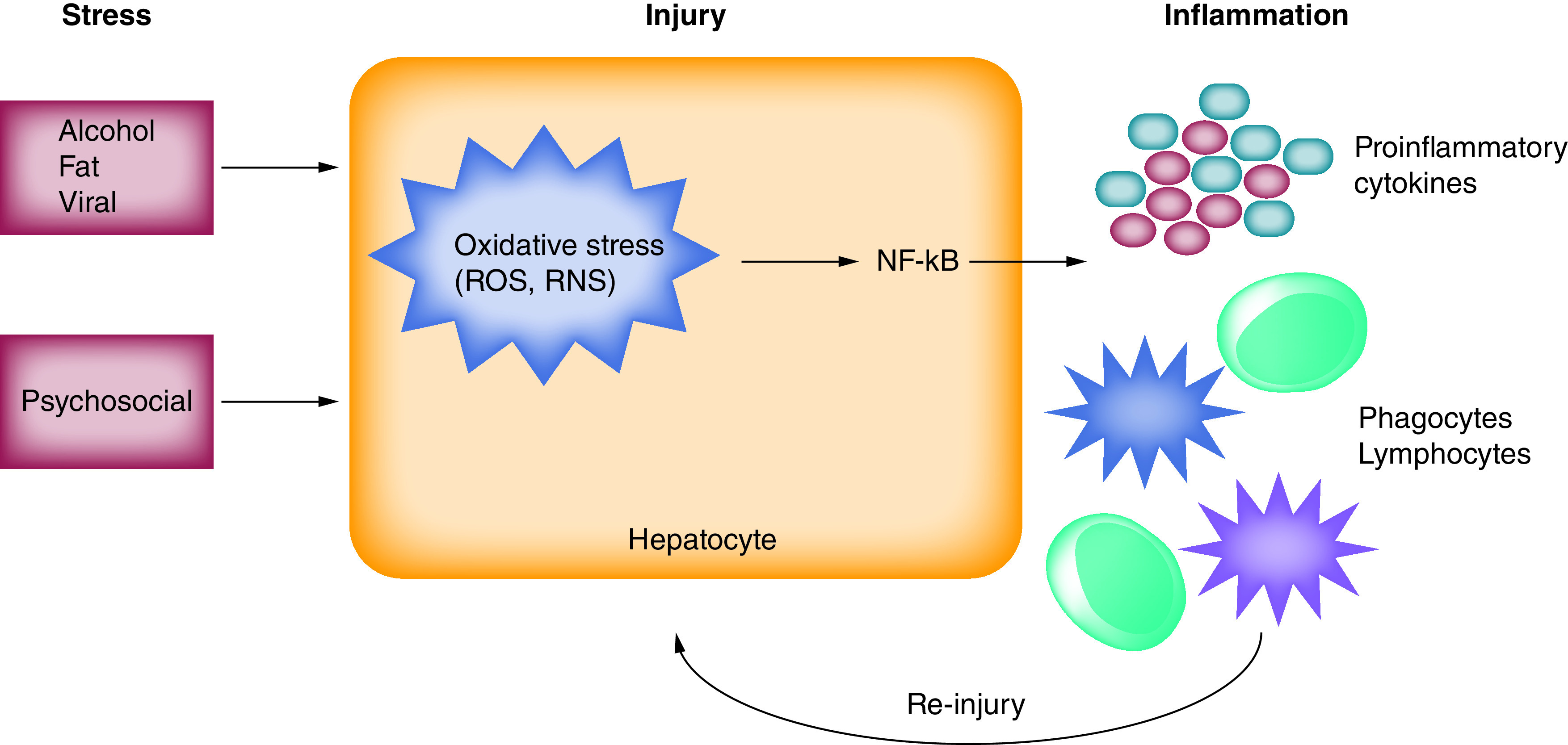 Hepatitis B-related hepatocellular carcinoma and stress: untangling the host immune response from clinical outcomes.