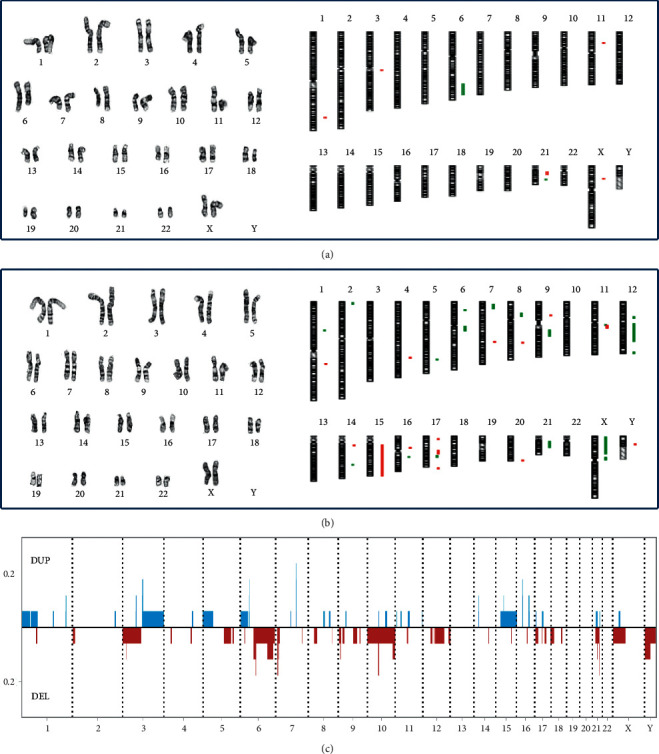 Cytogenomic Abnormalities in 19 Cases of Salivary Gland Tumors of Parotid Gland Origin.