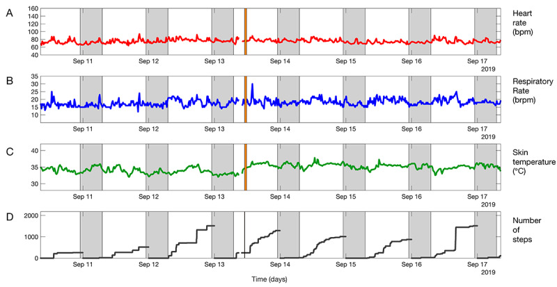 Wireless Remote Home Monitoring of Vital Signs in Patients Discharged Early After Esophagectomy: Observational Feasibility Study.