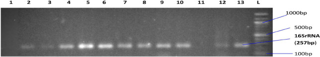 NASAL CARRIAGE OF MULTI-DRUG RESISTANT PANTON VALENTINE LEUKOCIDIN POSITIVE <i>STAPHYLOCOCCUS AUREUS</i> IN HEALTHY INDIVIDUALS OF TUDUN-WADA, GOMBE STATE, NIGERIA.