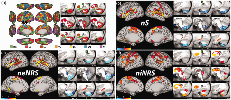 Pretreatment Brain Connectome Fingerprint Predicts Treatment Response in Major Depressive Disorder.