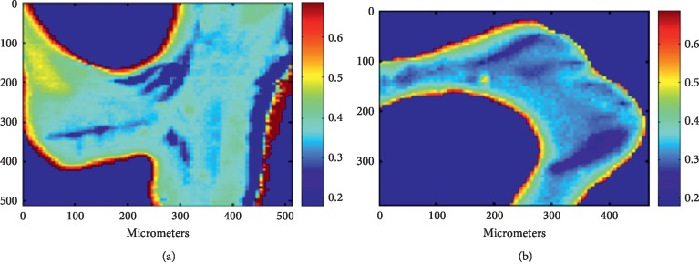 Correlation between Urine N-Terminal Telopeptide and Fourier Transform Infrared Spectroscopy Parameters: A Preliminary Study.