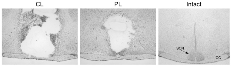 Suprachiasmatic lesions restore object recognition in down syndrome model mice