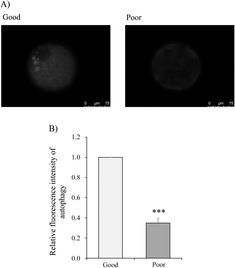 Effect of autophagy induction and cathepsin B inhibition on developmental competence of poor quality bovine oocytes.